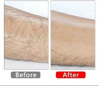 Lamelif Saplı Epilatör Tüy Dökücü