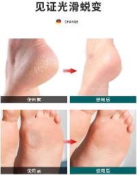 Lamelif Saplı Epilatör Tüy Dökücü